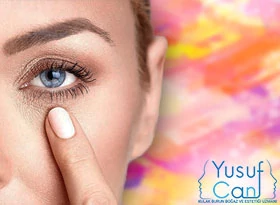 goz-cevresi-genclestirme